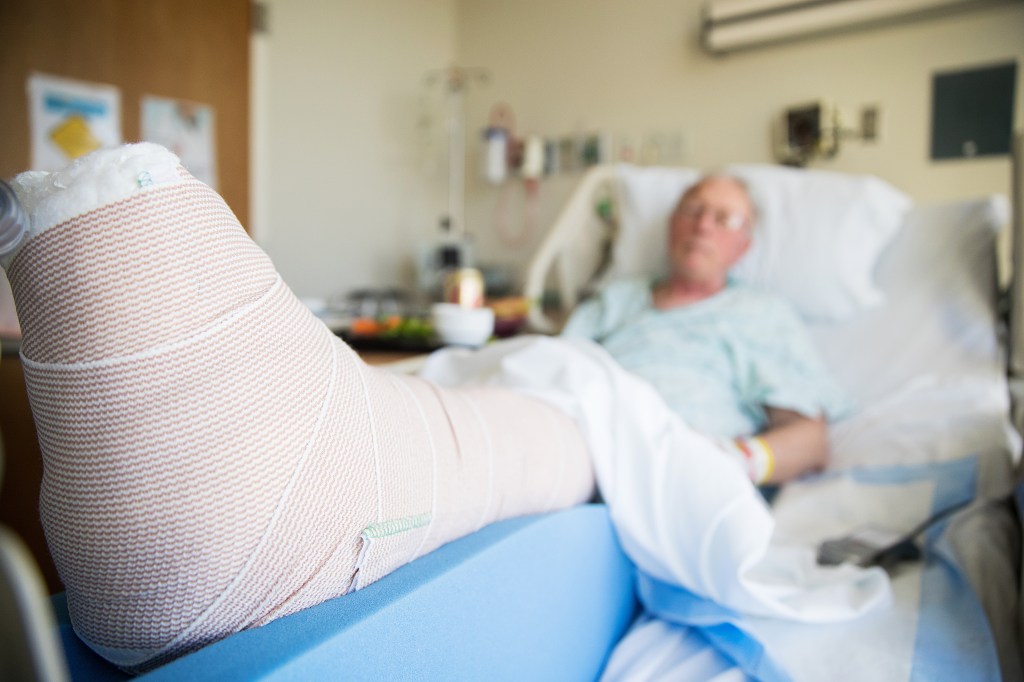 An elderly man in a hospital bed with his leg in a cast.
