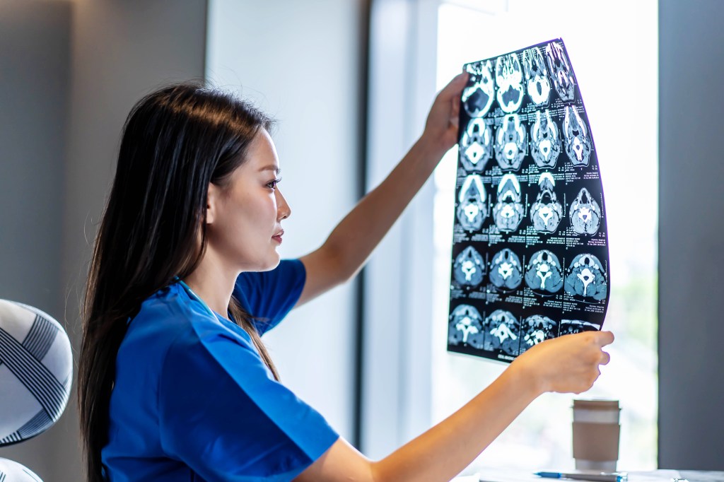 An Asian female doctor in blue scrubs examines a brain CT scan film by a window in a clinic.