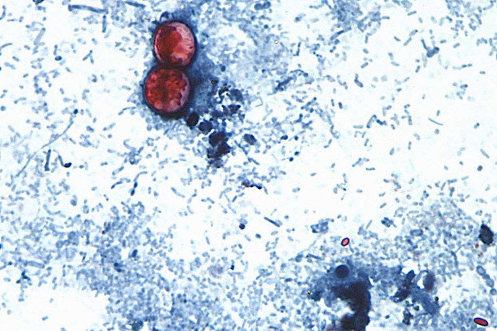 Microscopic view of Cyclospora cayetanensis oocysts in a stool sample.