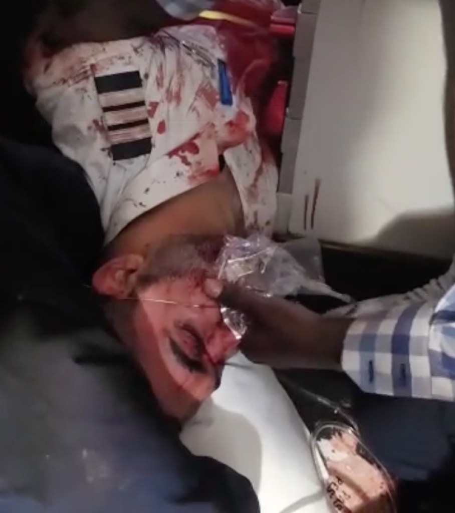 The injured and bound co-pilot of a FlyDubai flight is shown following an attack.