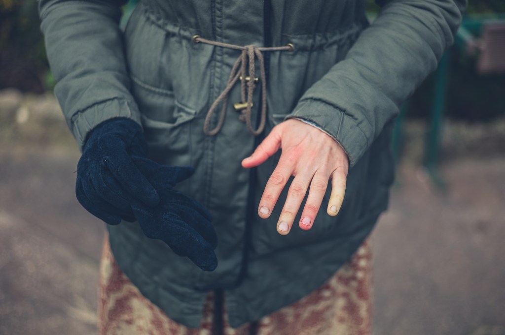 A woman outdoors in winter showing her bare hand affected by Raynaud's syndrome, with one finger turned white, while holding a glove in her other hand.